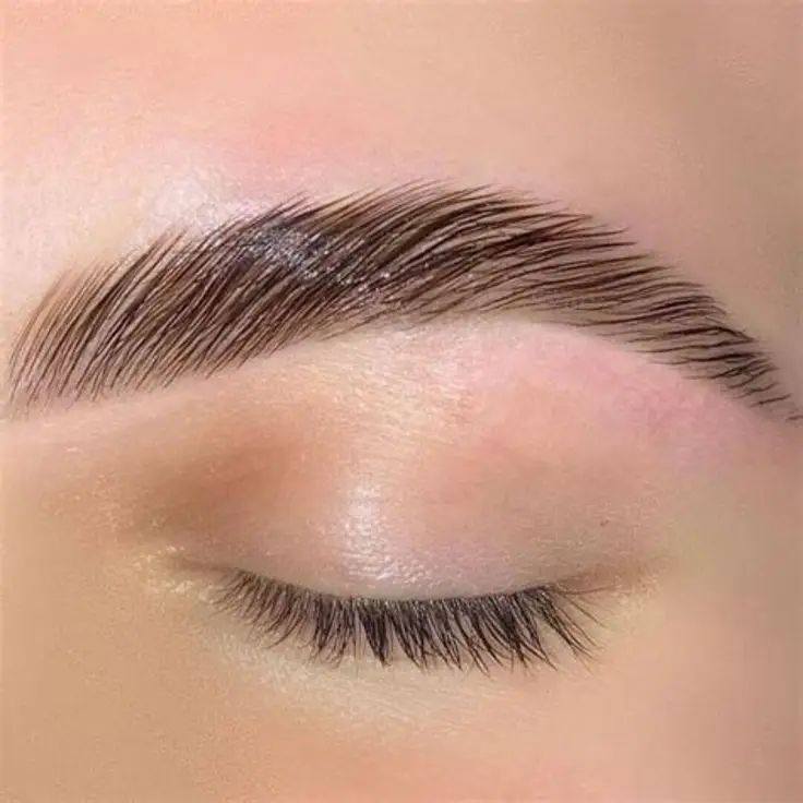 Brow Lift