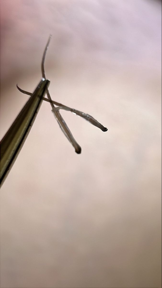 Électrolyse